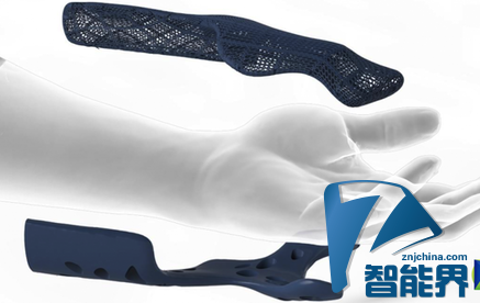 HEALX:用3D打印護(hù)具服務(wù)于肌肉損傷患者